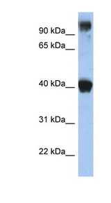TFAP2E Antibody - TFAP2E antibody Western blot of Fetal Stomach lysate. This image was taken for the unconjugated form of this product. Other forms have not been tested.