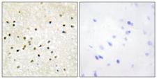 TFB1 / GTF2H1 Antibody - Immunohistochemistry analysis of paraffin-embedded human brain tissue, using TF2H1 Antibody. The picture on the right is blocked with the synthesized peptide.