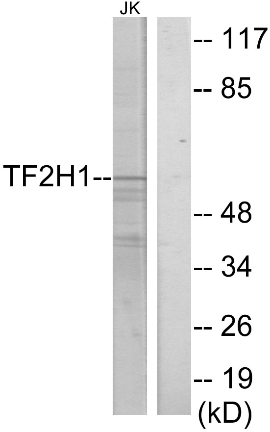 TFB1 / GTF2H1 Antibody - Western blot analysis of lysates from Jurkat cells, using TF2H1 Antibody. The lane on the right is blocked with the synthesized peptide.
