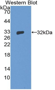 TFB1 / GTF2H1 Antibody - Western blot of recombinant TFB1 / GTF2H1.