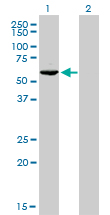 TFB1 / GTF2H1 Antibody - Western blot of GTF2H1 expression in transfected 293T cell line by GTF2H1 monoclonal antibody (M01), clone 1F12-1B5.