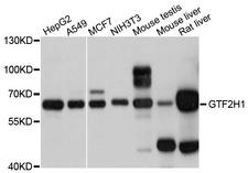 TFB1 / GTF2H1 Antibody - Western blot analysis of extracts of various cells.