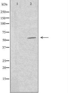 TFB1 / GTF2H1 Antibody - Western blot analysis of extracts of Jurkat cells using TF2H1 antibody. The lane on the left is treated with the antigen-specific peptide.