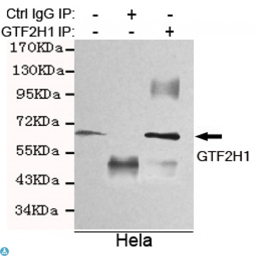 TFB1 / GTF2H1 Antibody - Immunoprecipitation analysis of Hela cell lysates using GTF2H1 mouse mAb.