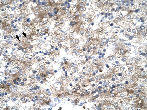TFB1 / GTF2H1 Antibody - GTF2H1 antibody P100811_T100-NP_005307-GTF2H1 (general transcription factor IIH, polypeptide 1, 62kDa) Antibody was used in IHC to stain formalin-fixed, paraffin-embedded human liver.  This image was taken for the unconjugated form of this product. Other forms have not been tested.