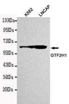TFB1 / GTF2H1 Antibody - Western blot detection of TFIIH (N-terminus) in LNCAP&K562 cell lysates using TFIIH (N-terminus) antibody (1:1000 diluted).