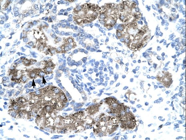 TFB1 / GTF2H1 Antibody - GTF2H1 antibody P100811_T100-NP_005307-GTF2H1 (general transcription factor IIH, polypeptide 1, 62kDa) Antibody was used in IHC to stain formalin-fixed, paraffin-embedded human kidney.  This image was taken for the unconjugated form of this product. Other forms have not been tested.