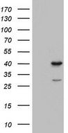 TFB1M Antibody - HEK293T cells were transfected with the pCMV6-ENTRY control. (Left lane) or pCMV6-ENTRY TFB1M. (Right lane) cDNA for 48 hrs and lysed. Equivalent amounts of cell lysates. (5 ug per lane) were separated by SDS-PAGE and immunoblotted with anti-TFB1M.