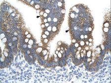 TFB2M Antibody - TFB2M antibody TFB2M(transcription factor B2, mitochondrial) Antibody was used in IHC to stain formalin-fixed, paraffin-embedded human intestine.  This image was taken for the unconjugated form of this product. Other forms have not been tested.