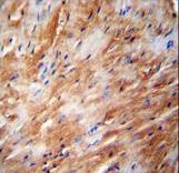 TFB2M Antibody - TFB2M Antibody immunohistochemistry of formalin-fixed and paraffin-embedded human heart carcinoma followed by peroxidase-conjugated secondary antibody and DAB staining.