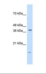 TFB2M Antibody - Transfected 293T cell lysate. Antibody concentration: 5.0 ug/ml. Gel concentration: 12%.  This image was taken for the unconjugated form of this product. Other forms have not been tested.