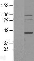 TFB2M Protein - Western validation with an anti-DDK antibody * L: Control HEK293 lysate R: Over-expression lysate