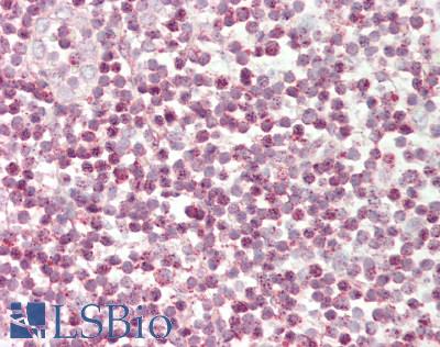 TFCP2 / CP2 Antibody - Human Tonsil: Formalin-Fixed, Paraffin-Embedded (FFPE).  This image was taken for the unconjugated form of this product. Other forms have not been tested.