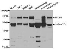 TFCP2 / CP2 Antibody - Western blot analysis of extracts of various cell lines.