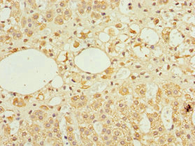 TFCP2 / CP2 Antibody - Immunohistochemistry of paraffin-embedded human adrenal gland tissue at dilution 1:100