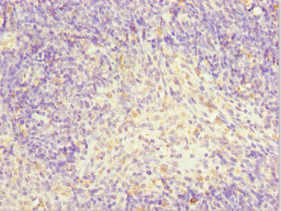 TFCP2 / CP2 Antibody - Immunohistochemistry of paraffin-embedded human thymus tissue at dilution 1:100