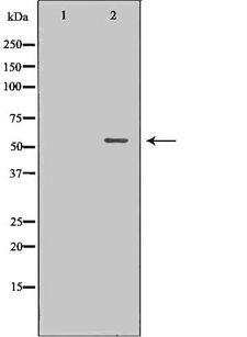 TFCP2 / CP2 Antibody - Western blot analysis of 293T whole cells lysates using TFCP2 antibody. The lane on the left is treated with the antigen-specific peptide.