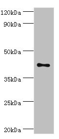 TFDP1 Antibody - Western blot All lanes: Transcription factor Dp-1 antibody at 2µg/ml + HepG2 whole cell lysate Secondary Goat polyclonal to rabbit IgG at 1/10000 dilution Predicted band size: 46, 35 kDa Observed band size: 46 kDa