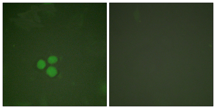 TFDP1 Antibody - Immunofluorescence analysis of HeLa cells, using DP-1 Antibody. The picture on the right is blocked with the synthesized peptide.
