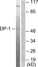 TFDP1 Antibody - Western blot analysis of lysates from HeLa cells, using DP-1 Antibody. The lane on the right is blocked with the synthesized peptide.