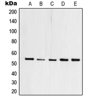 TFDP1 Antibody - Western blot analysis of TFDP1 expression in HEK293T (A); A431 (B); Raji (C); mouse heart (D); PC12 (E) whole cell lysates.