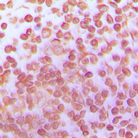 TFDP1 Antibody - Immunohistochemical analysis of TFDP1 staining in human tonsil formalin fixed paraffin embedded tissue section. The section was pre-treated using heat mediated antigen retrieval with sodium citrate buffer (pH 6.0). The section was then incubated with the antibody at room temperature and detected using an HRP conjugated compact polymer system. DAB was used as the chromogen. The section was then counterstained with hematoxylin and mounted with DPX.