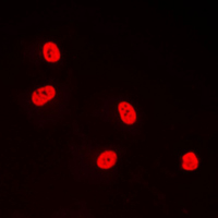TFDP1 Antibody - Immunofluorescent analysis of TFDP1 staining in A431 cells. Formalin-fixed cells were permeabilized with 0.1% Triton X-100 in TBS for 5-10 minutes and blocked with 3% BSA-PBS for 30 minutes at room temperature. Cells were probed with the primary antibody in 3% BSA-PBS and incubated overnight at 4 C in a humidified chamber. Cells were washed with PBST and incubated with a DyLight 594-conjugated secondary antibody (red) in PBS at room temperature in the dark. DAPI was used to stain the cell nuclei (blue).