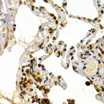 TFDP1 Antibody - Immunohistochemistry of paraffin-embedded human normal lung tissue.