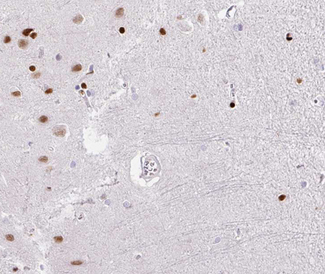 TFDP1 Antibody - 1:100 staining human brain tissue by IHC-P. The tissue was formaldehyde fixed and a heat mediated antigen retrieval step in citrate buffer was performed. The tissue was then blocked and incubated with the antibody for 1.5 hours at 22°C. An HRP conjugated goat anti-rabbit antibody was used as the secondary.