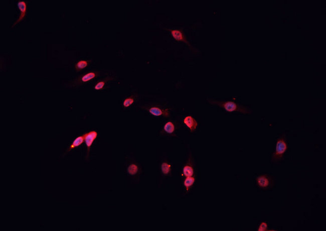 TFDP1 Antibody - Staining HeLa cells by IF/ICC. The samples were fixed with PFA and permeabilized in 0.1% Triton X-100, then blocked in 10% serum for 45 min at 25°C. The primary antibody was diluted at 1:200 and incubated with the sample for 1 hour at 37°C. An Alexa Fluor 594 conjugated goat anti-rabbit IgG (H+L) antibody, diluted at 1/600, was used as secondary antibody.