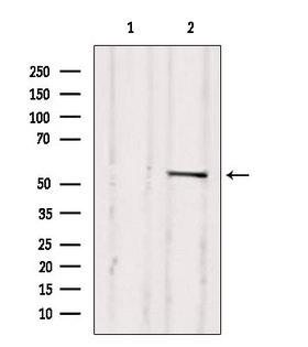 TFDP1 Antibody - Western blot analysis of extracts of 293 cells using TFDP1 antibody. Lane 1 was treated with the blocking peptide.