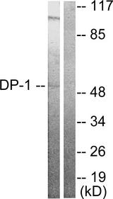 TFDP1 Antibody - Western blot analysis of extracts from HeLa cells, using DP-1 antibody.