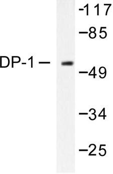 TFDP1 Antibody - Western blot of DP-1/TFDP1 (V393) pAb in extracts from HeLa cells.