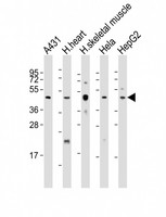 TFDP2 / DP2 Antibody - All lanes: Anti-TFDP2 Antibody (Center) at 1:2000 dilution. Lane 1: A431 whole cell lysate. Lane 2: human heart lysate. Lane 3: human skeletal muscle whole cell lysate. Lane 4: HeLa whole cell lysate. Lane 5: HepG2 whole cell lysate Lysates/proteins at 20 ug per lane. Secondary Goat Anti-Rabbit IgG, (H+L), Peroxidase conjugated at 1:10000 dilution. Predicted band size: 49 kDa. Blocking/Dilution buffer: 5% NFDM/TBST.