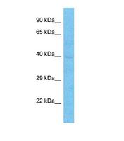 TFDP2 / DP2 Antibody - Western blot of Human Thyroid Tumor. TFDP2 antibody dilution 1.0 ug/ml.  This image was taken for the unconjugated form of this product. Other forms have not been tested.