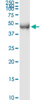 TFDP2 / DP2 Antibody - TFDP2 monoclonal antibody (M01), clone 2E6. Western Blot analysis of TFDP2 expression in human colon.