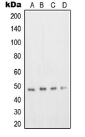 TFDP2 / DP2 Antibody - Western blot analysis of DP2 expression in Jurkat (A); A431 (B); Hep G2 (C); COS7 (D) whole cell lysates.