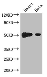 TFDP2 / DP2 Antibody - Positive WB detected in:Mouse heart tissue,Hela whole cell lysate;All lanes: TFDP2 antibody at 3.2ug/ml;Secondary;Goat polyclonal to rabbit IgG at 1/50000000 dilution;Predicted band size: 50,41,42,43,40,35,47 kDa;Observed band size: 50 kDa;