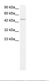 TFDP2 / DP2 Antibody - Jurkat Cell Lysate.  This image was taken for the unconjugated form of this product. Other forms have not been tested.