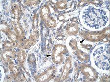 TFDP2 / DP2 Antibody - TFDP2 / Dp-2 antibody ARP33438_T100-NP_006277-TFDP2 (transcription factor Dp-2 (E2F dimerization partner 2)) Antibody was used in IHC to stain formalin-fixed, paraffin-embedded human kidney.  This image was taken for the unconjugated form of this product. Other forms have not been tested.