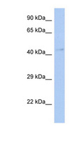 TFDP3 Antibody - TFDP3 antibody Western blot of Fetal Kidney lysate. This image was taken for the unconjugated form of this product. Other forms have not been tested.