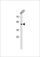 TFDP3 Antibody - TFDP3 Antibody western blot of WiDr cell line lysates (35 ug/lane). The TFDP3 antibody detected the TFDP3 protein (arrow).