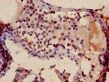 TFDP3 Antibody - Immunohistochemistry image of paraffin-embedded human testis tissue at a dilution of 1:100