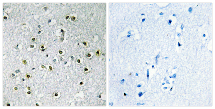 TFE3 Antibody - Immunohistochemistry analysis of paraffin-embedded human brain tissue, using TFE3 Antibody. The picture on the right is blocked with the synthesized peptide.