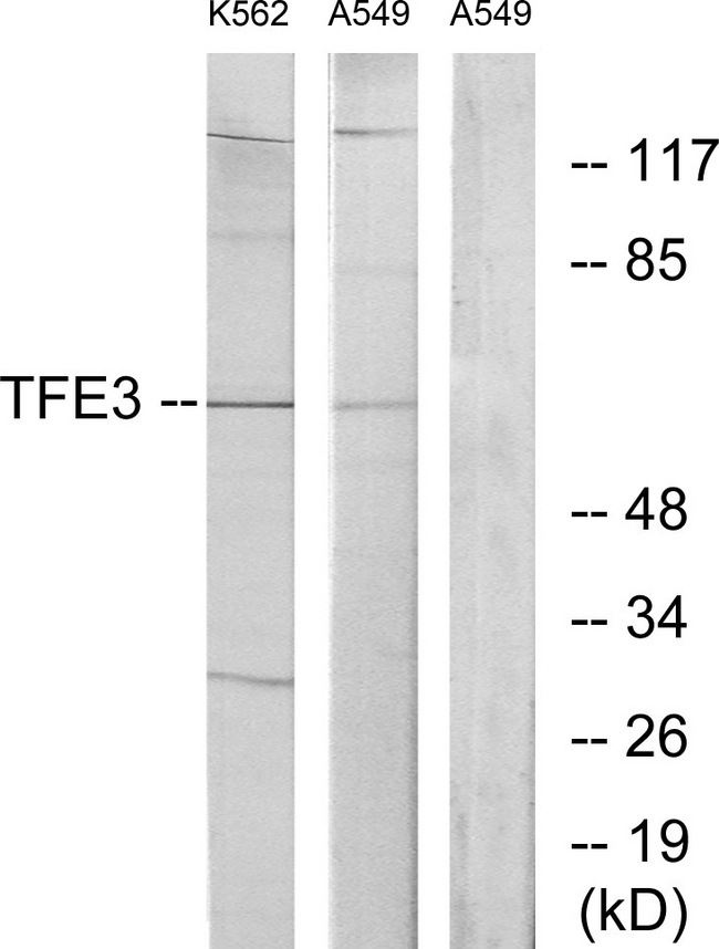 TFE3 Antibody - Western blot analysis of lysates from K562 and A549 cells, using TFE3 Antibody. The lane on the right is blocked with the synthesized peptide.