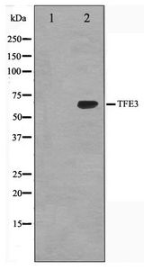 TFE3 Antibody - Western blot of K562 cell lysate using TFE3 Antibody