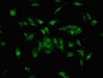 TFE3 Antibody - Immunofluorescent analysis of Hela cells at a dilution of 1:100 and Alexa Fluor 488-congugated AffiniPure Goat Anti-Rabbit IgG(H+L)