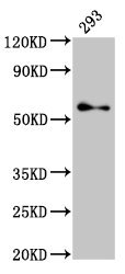 TFE3 Antibody - Western Blot Positive WB detected in: 293 whole cell lysate All lanes: TFE3 antibody at 2.7µg/ml Secondary Goat polyclonal to rabbit IgG at 1/50000 dilution Predicted band size: 62, 12 kDa Observed band size: 62 kDa