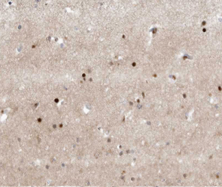 TFE3 Antibody - 1:100 staining human brain tissue by IHC-P. The tissue was formaldehyde fixed and a heat mediated antigen retrieval step in citrate buffer was performed. The tissue was then blocked and incubated with the antibody for 1.5 hours at 22°C. An HRP conjugated goat anti-rabbit antibody was used as the secondary.