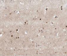 TFE3 Antibody - 1:100 staining human brain tissue by IHC-P. The tissue was formaldehyde fixed and a heat mediated antigen retrieval step in citrate buffer was performed. The tissue was then blocked and incubated with the antibody for 1.5 hours at 22°C. An HRP conjugated goat anti-rabbit antibody was used as the secondary.